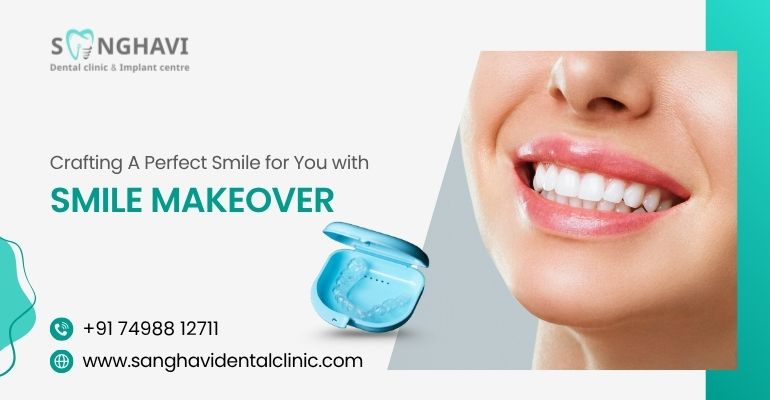Crafting a Perfect Smile for You with Smile Makeover