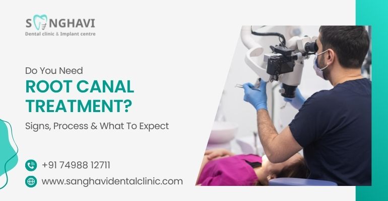 Do You Need Root Canal Treatment? Signs, Process, and What to Expect