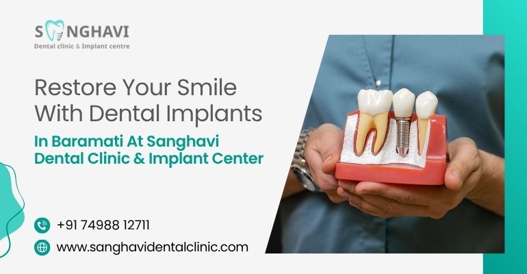 Restore Your Smile with Dental Implants in Baramati at Sanghavi Dental Clinic & Implant Center
