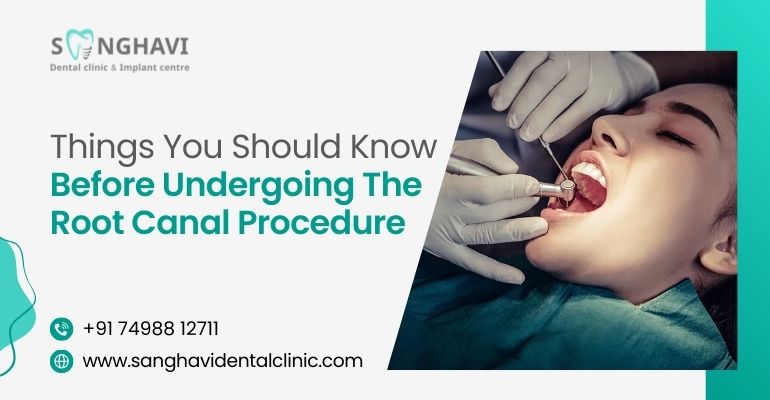 Things You Should Know Before Undergoing the Root Canal Procedure